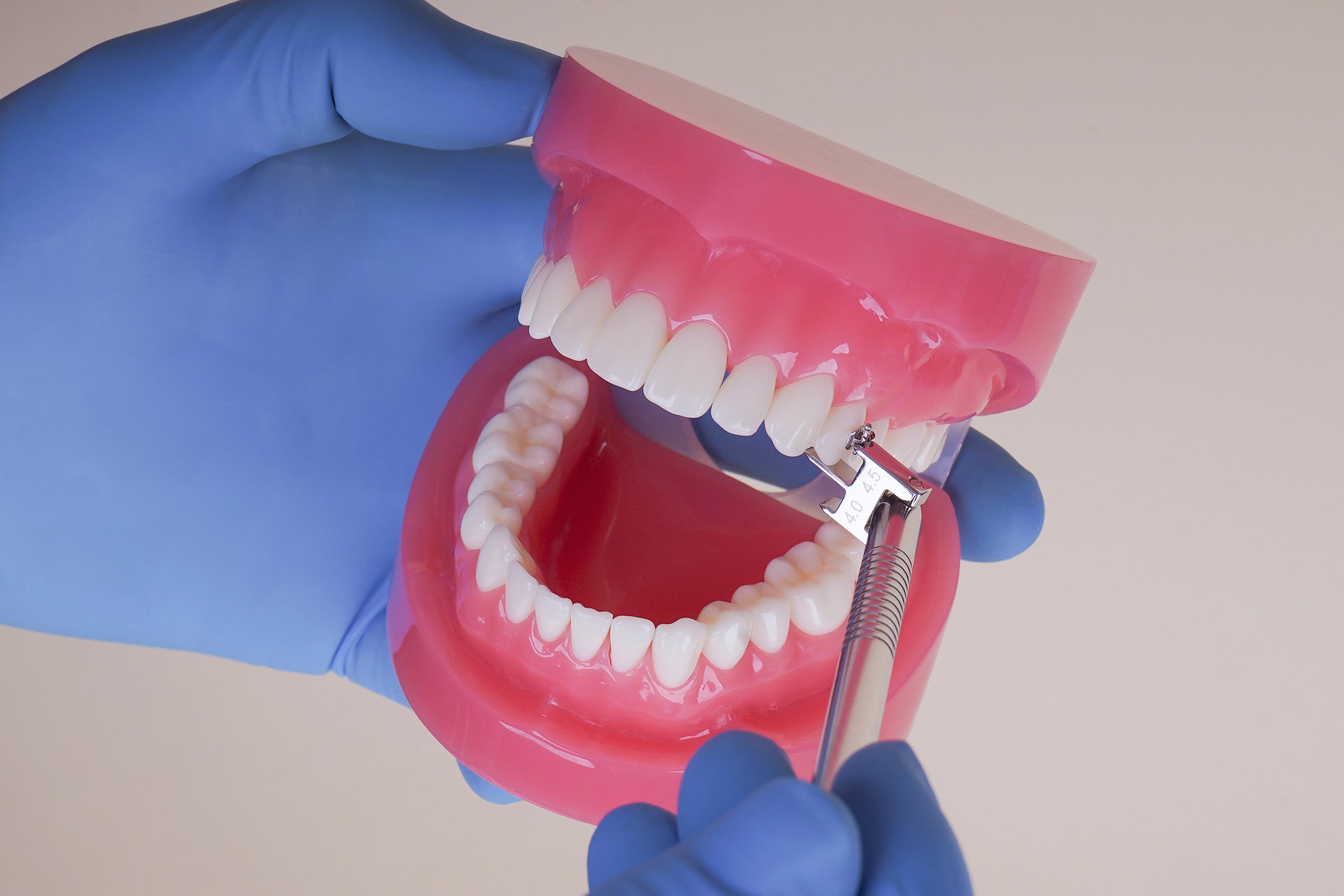 Brackets Alexander Posicionador de brackets Alexander